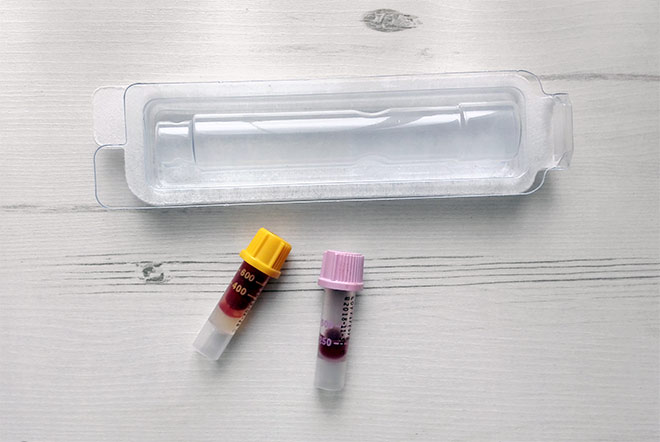 filled collection tubes with protective packaging