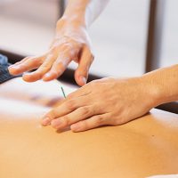 Can you exercise after an acupuncture treatment? Can you exercise after an acupuncture treatment?