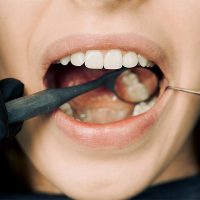 The Comprehensive Guide to the Importance of Gum Health in Oral Care The Comprehensive Guide to the Importance of Gum Health in Oral Care