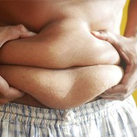 How Does Obesity Affect Men's Sexual Health? How Does Obesity Affect Men's Sexual Health?
