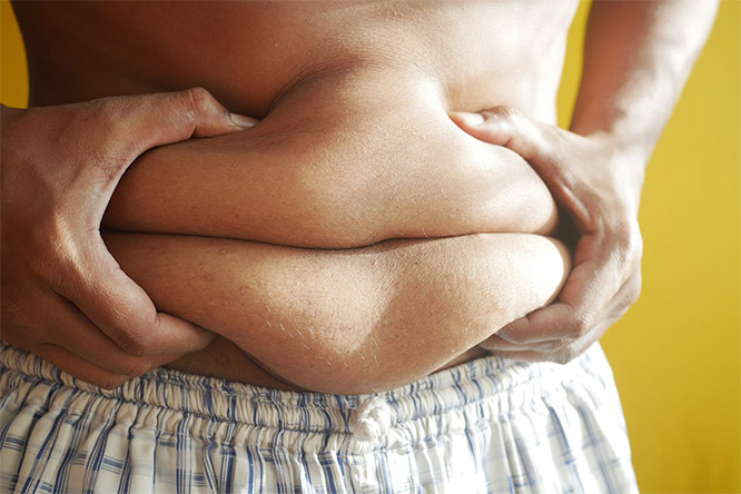 obese man