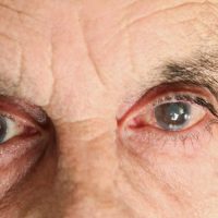 The Signs & Symptoms Of Glaucoma: What To Do The Signs & Symptoms Of Glaucoma: What To Do